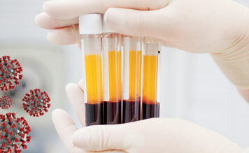 Plasma_Therapy_Treatment_Covid_19_Treatment
