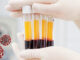 Plasma_Therapy_Treatment_Covid_19_Treatment